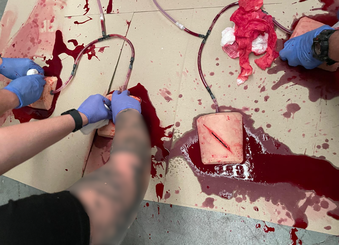 Wound packing
